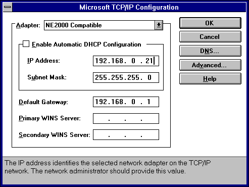 IP-Adresse festlegen